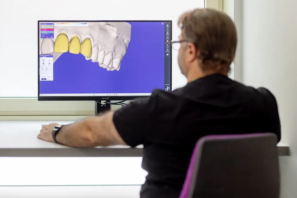 Digitale Planung des Zahnersatzes am Bildschirm im Zahnzentrum Olpe